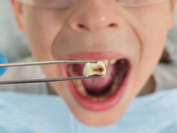 Best Broken Tooth Emergency  in Kaneohe, HI